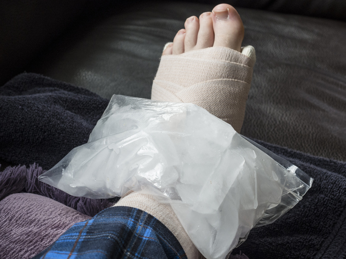 Bag of ice on an injured ankle