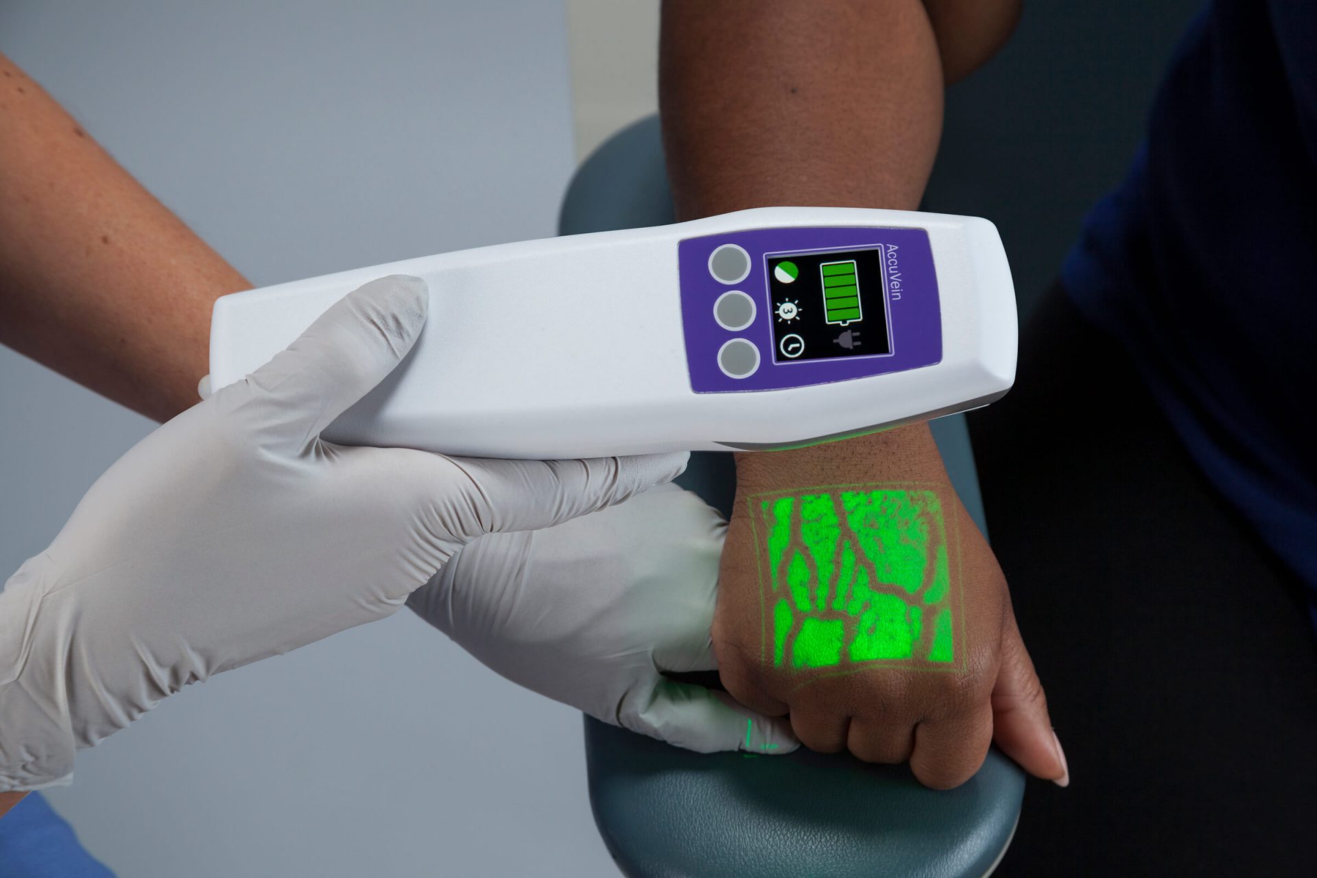 Doctor using the vein finder over the hand of a patient with a green light showing the veins in the hand